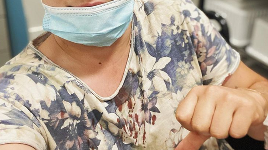 Superstarista skončil v nemocnici! Zrazil ho motocykel