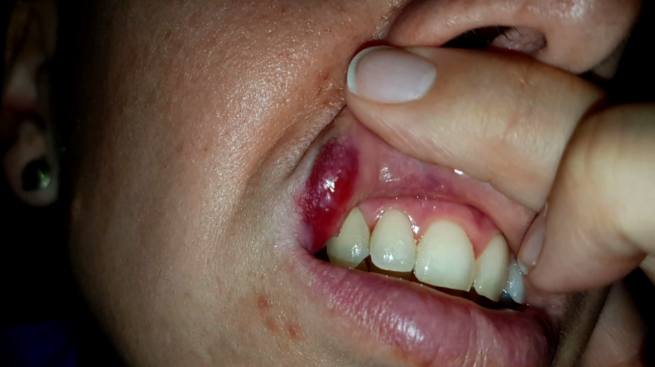 Peklo na slovenskej diaľnici! Mlátil ju pred malými deťmi a blokoval premávku