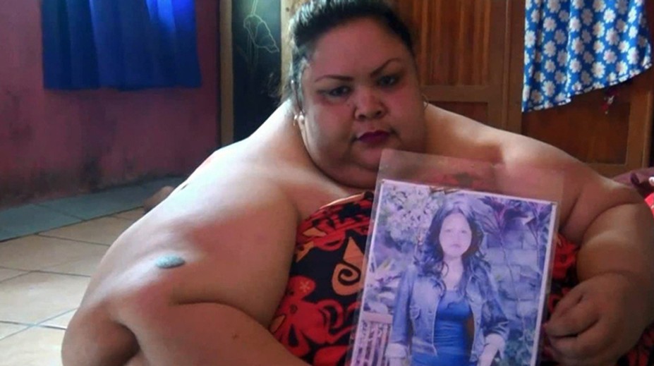 Titi (37) je už taká obézna, že iba leží. Pred rokmi však mala postavu modelky