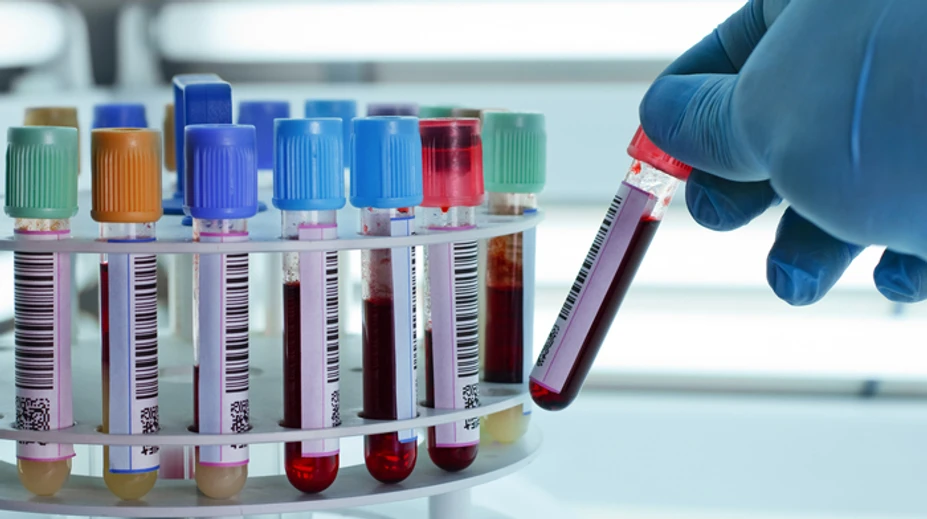 Transfúziám svitá nová nádej: Vedci dokázali zmeniť krvnú skupinu A na univerzálnu 0