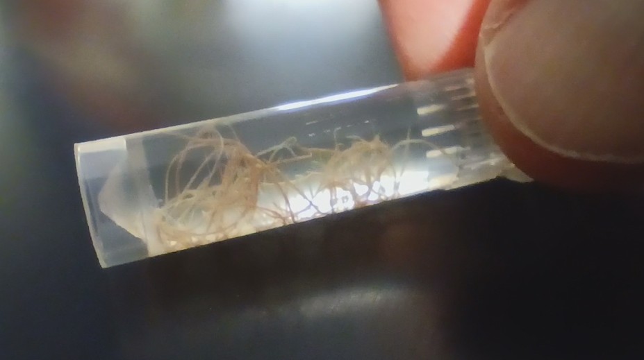 Nenápadný zabijak domácich miláčikov. Veterinári upozorňujú na pľúcne červy