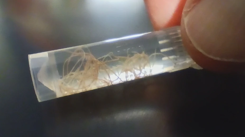 Nenápadný zabijak domácich miláčikov. Veterinári upozorňujú na pľúcne červy
