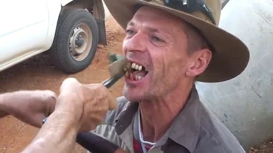 Takéto trhanie zubov ste ešte nevideli. Video je len pre odolných