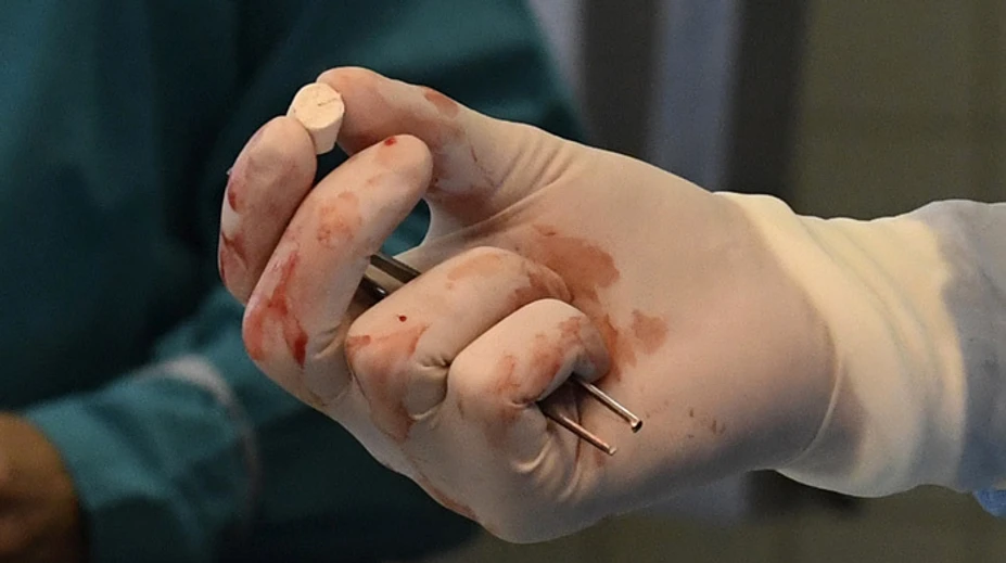 Košickí vedci vyvinuli unikátny biomateriál
