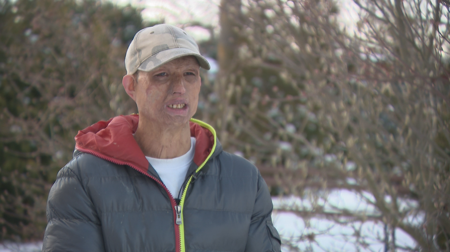 S rodinou býva v ubytovni, roky si márne hľadá prácu. Problém vidí v tom, ako vyzerá