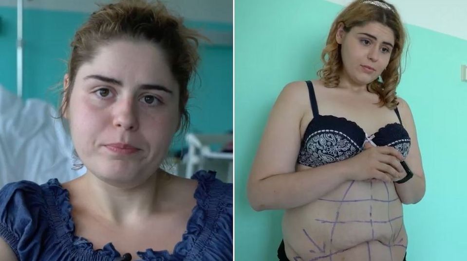 Extrémne premeny – Operácie – Silvia