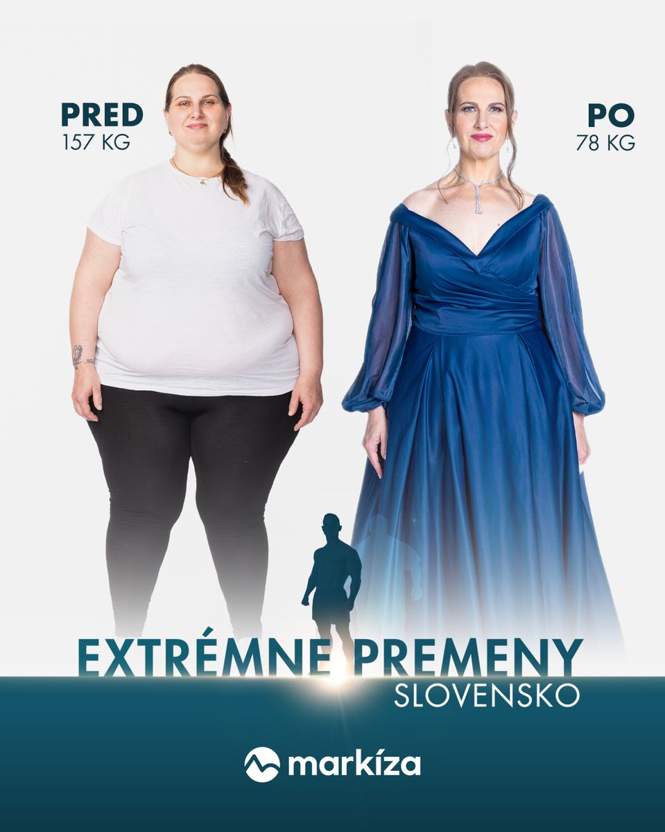 Kamila Zemančíková v šou Extrémne premeny Slovensko - Druhá šanca na život (Pred a Po)