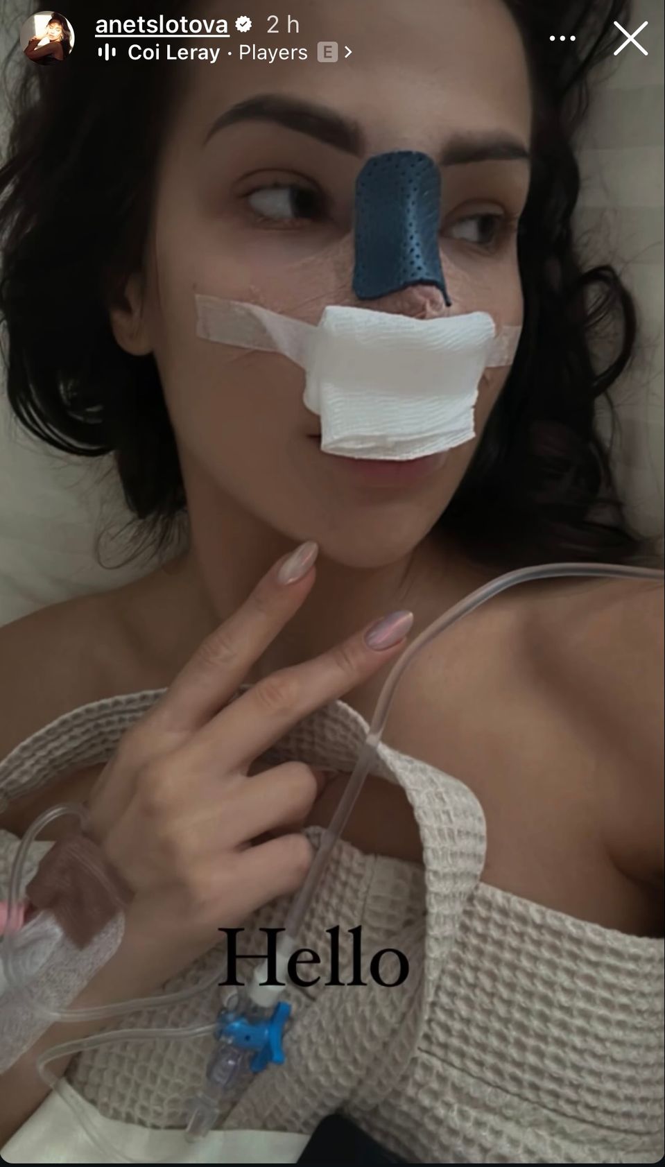 Anet z Ruže podstúpila plastiku