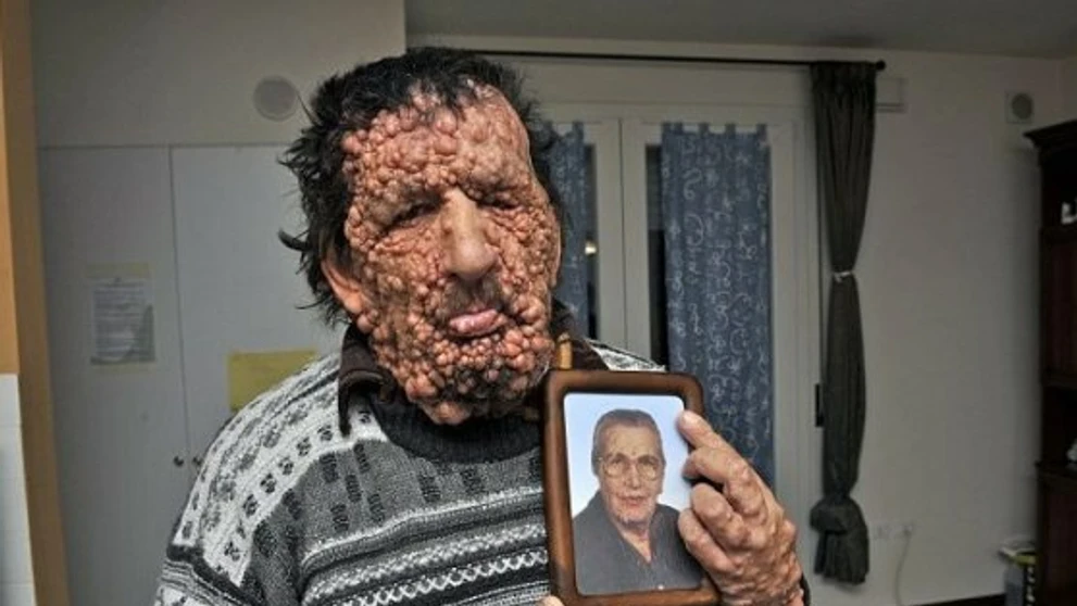 Sloní muž