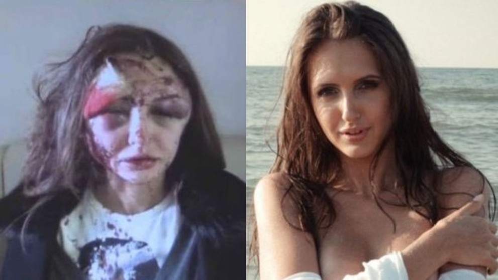 Modelka Alexandra Sereda po útoku a pred