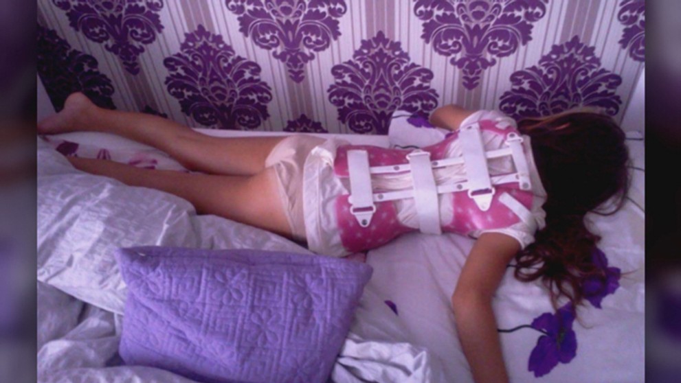 Elizabeth Helbichová po operácii.