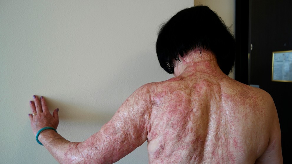 Kim Phuc
