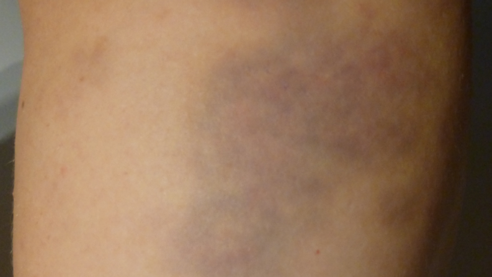 Policajná brutalita