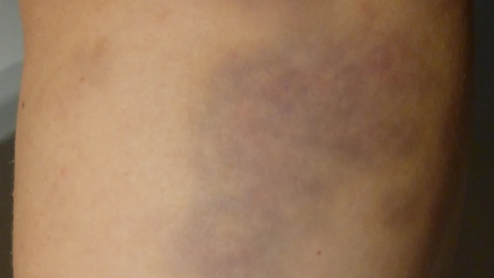 Policajná brutalita