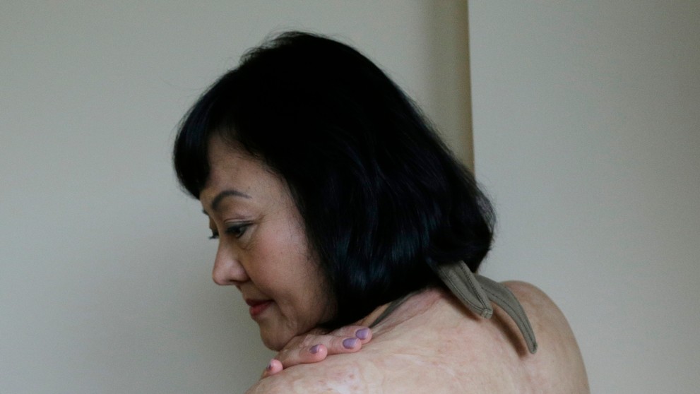 Kim Phuc