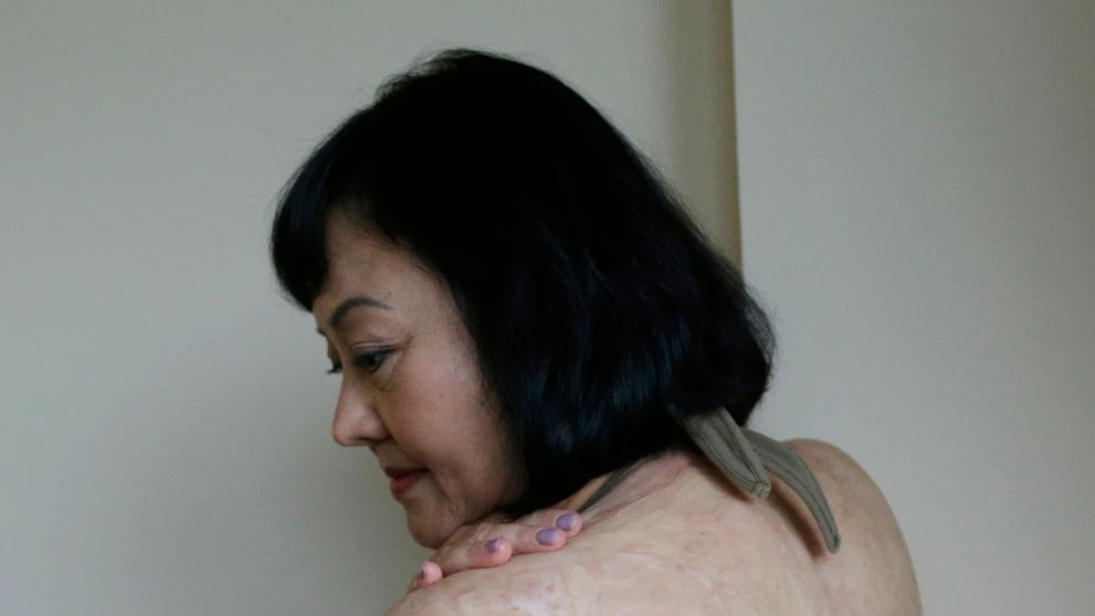 Kim Phuc