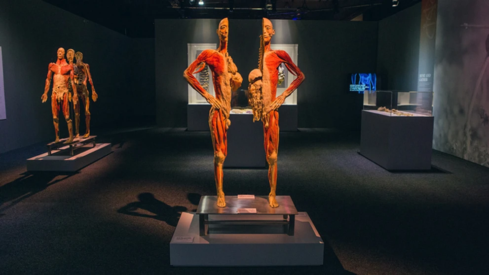 Exponát z výstavy Body The Exhibition.
