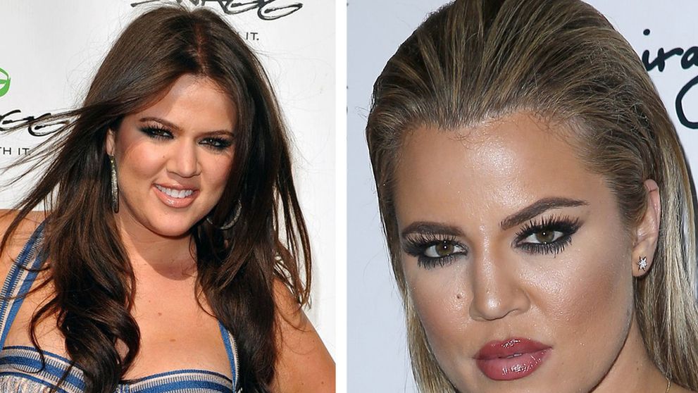Čím ďalej tým viac neprirodzená. Preplastikovaná Kardashianka