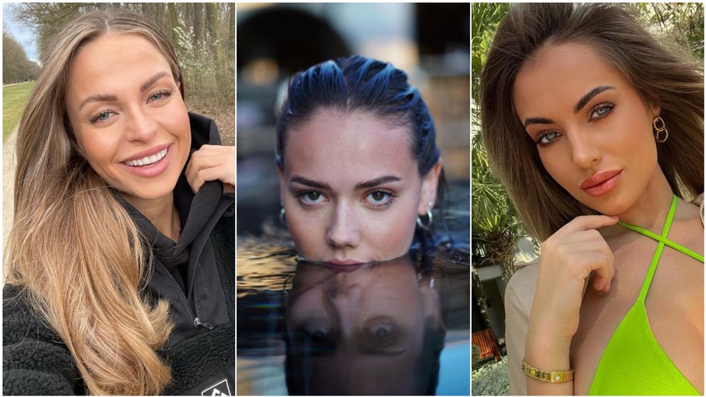 Po návrate z Love Islandu zamierili pod nôž. Pozrite, ako sa obľúbené srdiečka zmenili