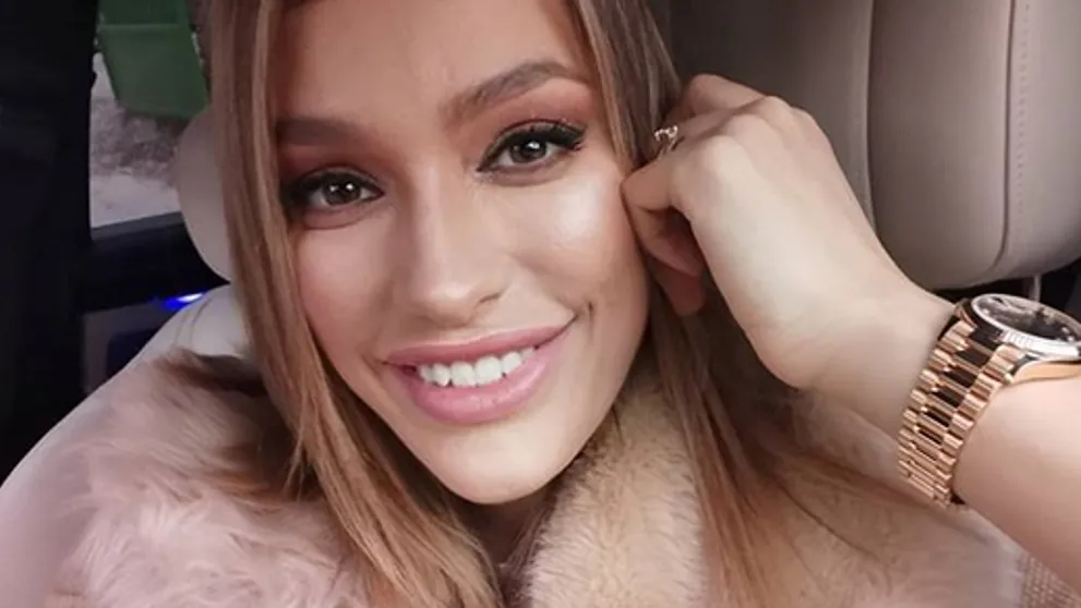 Jasmina radikálne zmenila účes: Ľudia však riešia jej pery