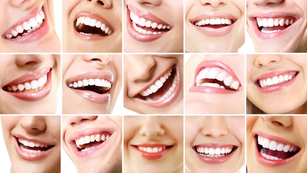 Ktorá slovenská celebrita má najkrajší úsmev?