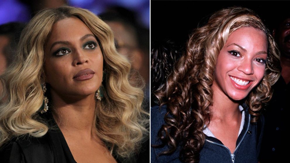 Beyoncé na nových fotkách. Chirurg prezradil, čo všetko si nechala vylepšiť