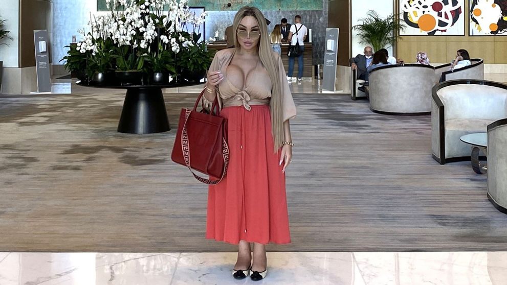 Jessica Alves chcela oči ako Bella Hadid. Preoperovaná Barbie však naháňa strach!