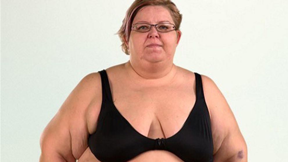 Pripútaná k stoličke: Silvia kvôli obezite nemohla ani chodiť!