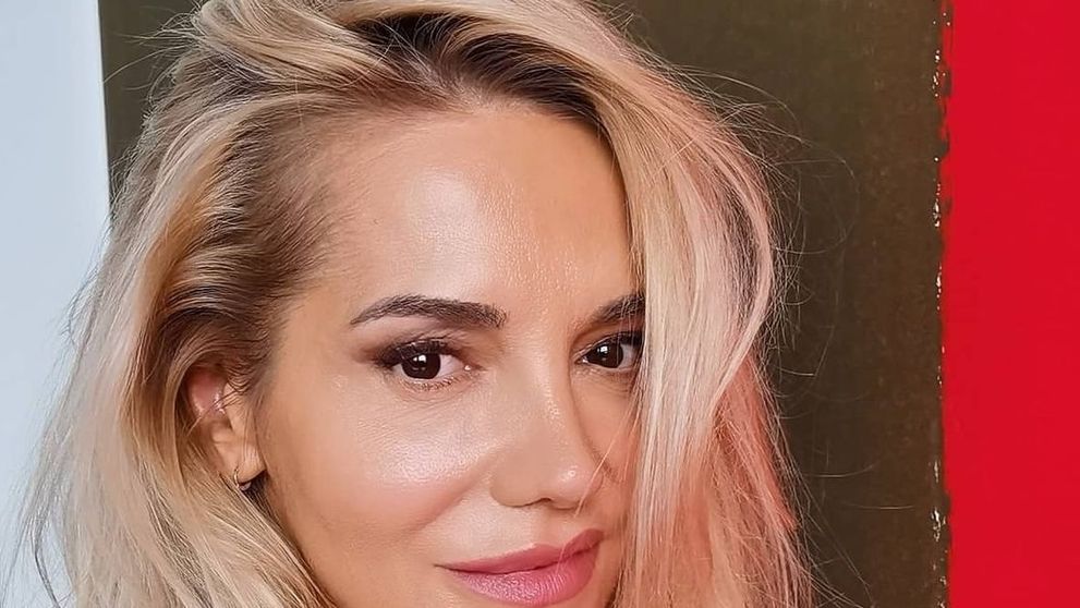 Dara si nechala upraviť nos. Samozvaným odborníkom posiela odkaz