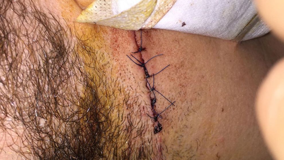 Desivé spomienky exfarmára: Stačilo málo a mohol vykrvácať!