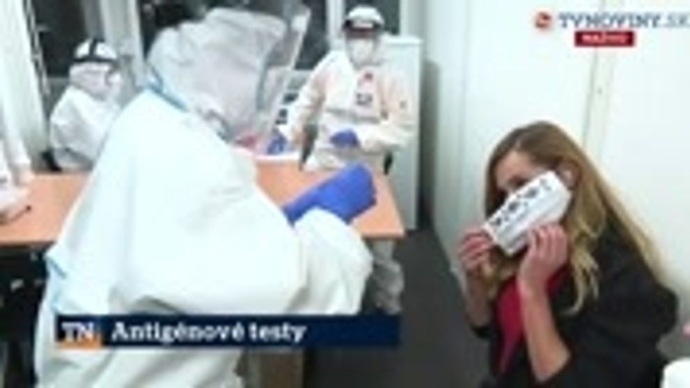 Známa herečka sa namotala na markizácky seriál: Natrel ju kolega