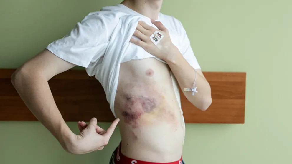 Škaredý pád z okna: Mladý herec skončil dochrámaný v nemocnici!
