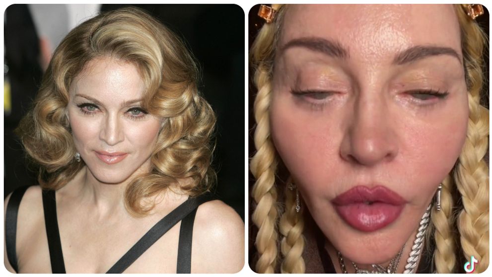 Keď sa počet plastík preženie: Chirurg prehovoril o slávnych menách