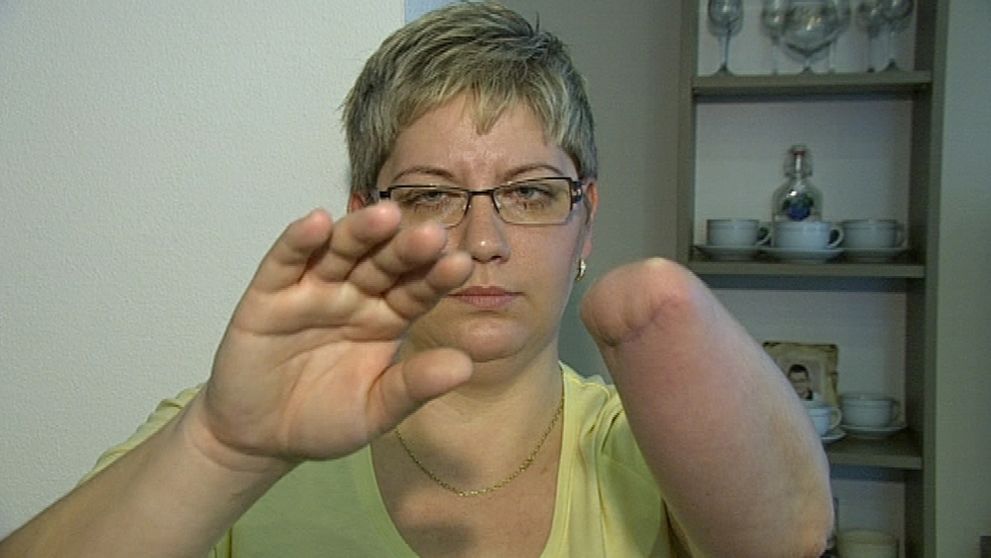 Kvôli lekárom prišla o ruku