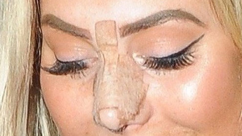 Reality hviezda tesne po plastike na verejnosti: Mala radšej zostať doma