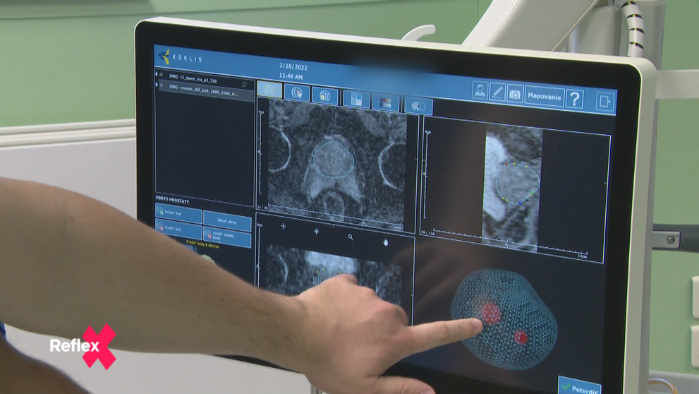 Fúzy nie sú len na ozdobu!