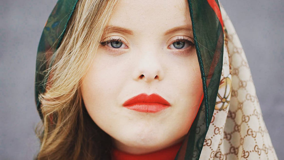 Svet sa hýbe dobrým smerom: Modelka s downovým syndrómom dosiahla obrovský úspech