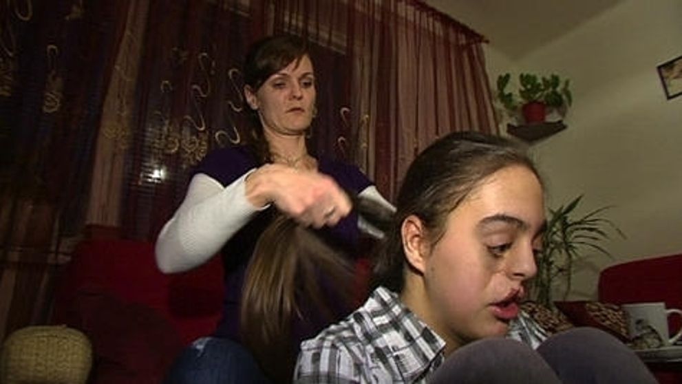 Simonka má ojedinelý rázštep tváre!