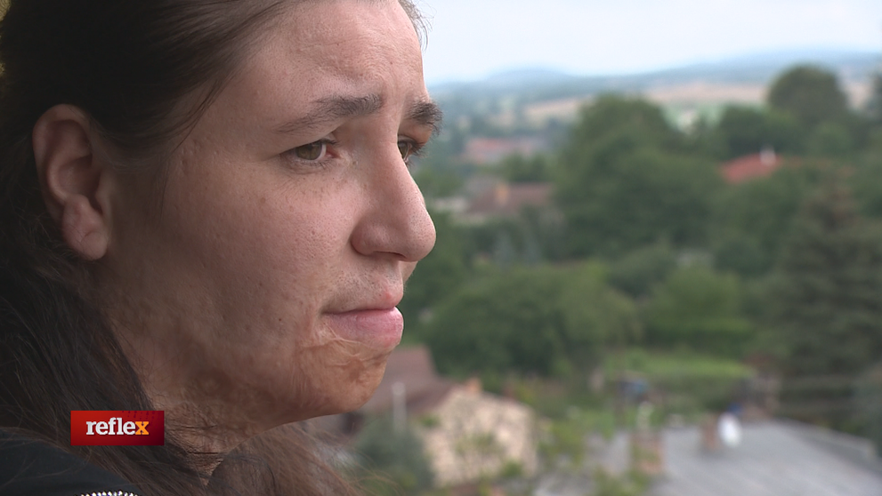 Výbuch jej obrátil život