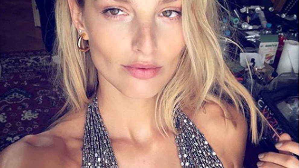 Pod fotkou našej topmodelky sa strhla diskusia. Sú umelé či nie?