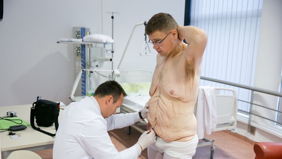 Plastický chirurg Martin Boháč odhalil zákulisie Extrémnych premien. Nie všetko ste videli