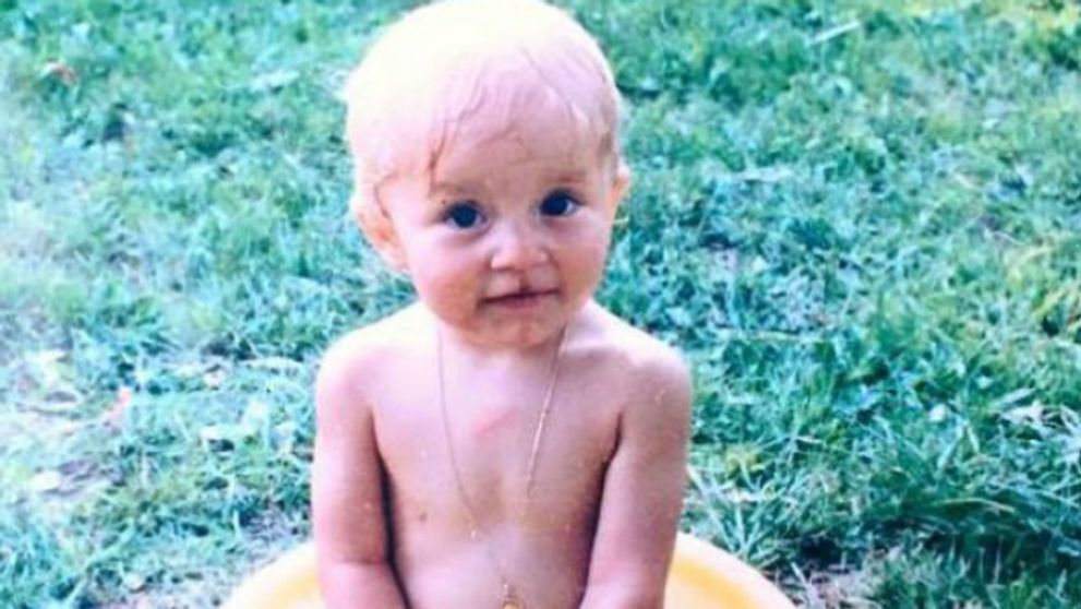 Telenovelová kráska ukázala fotku z detstva: Narodila sa s rázštepom pery!