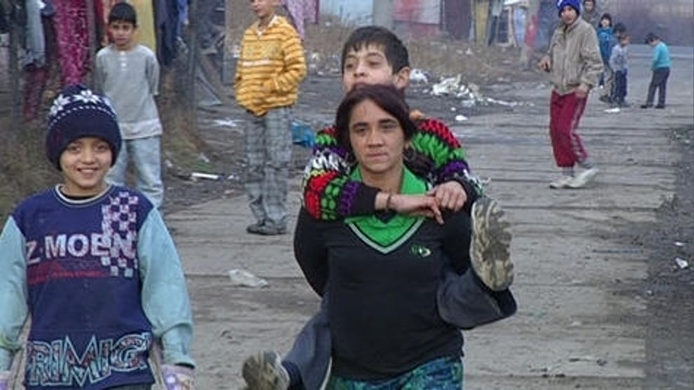 Ivan sa narodil s kolenami naopak!