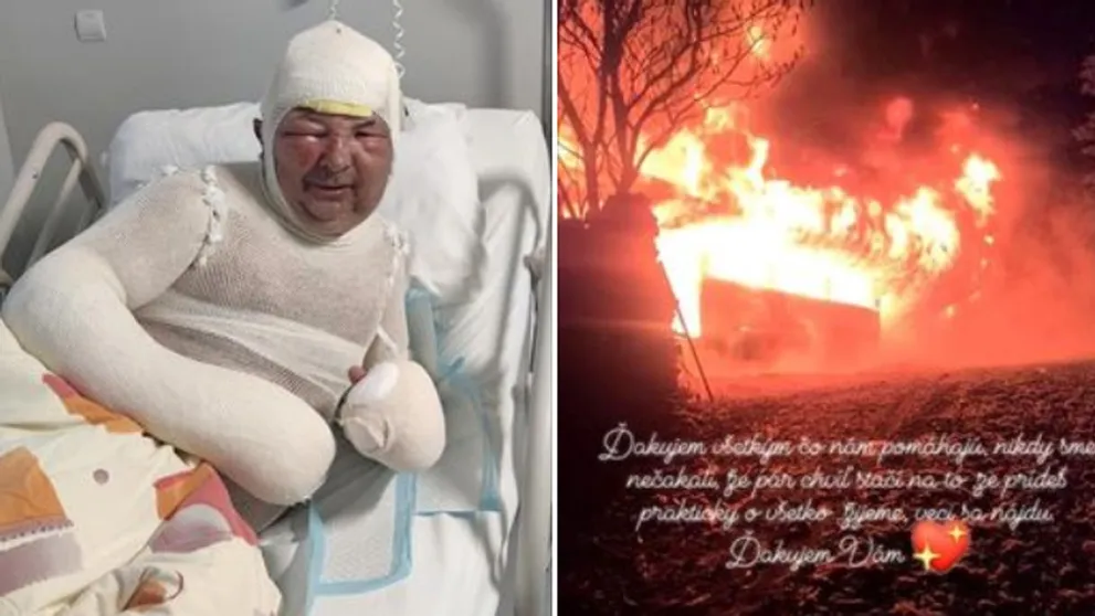 Tragédia: Účinkujúcemu z Farmy zhorel dom do tla a utrpel rozsiahle popáleniny
