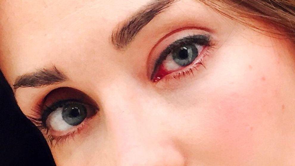 Ako naschvál: Pár dní pred svadbou a... Oči ako angorák!