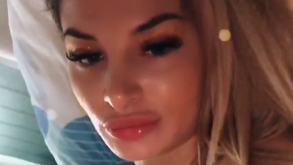 Zuzana Plačková si nechala zmenšiť prsia. Už je po operácii