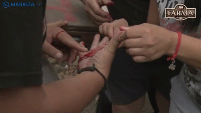 Úraz na Farme! Tiekla krv!