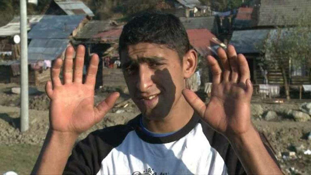 Príroda ich znetvorila