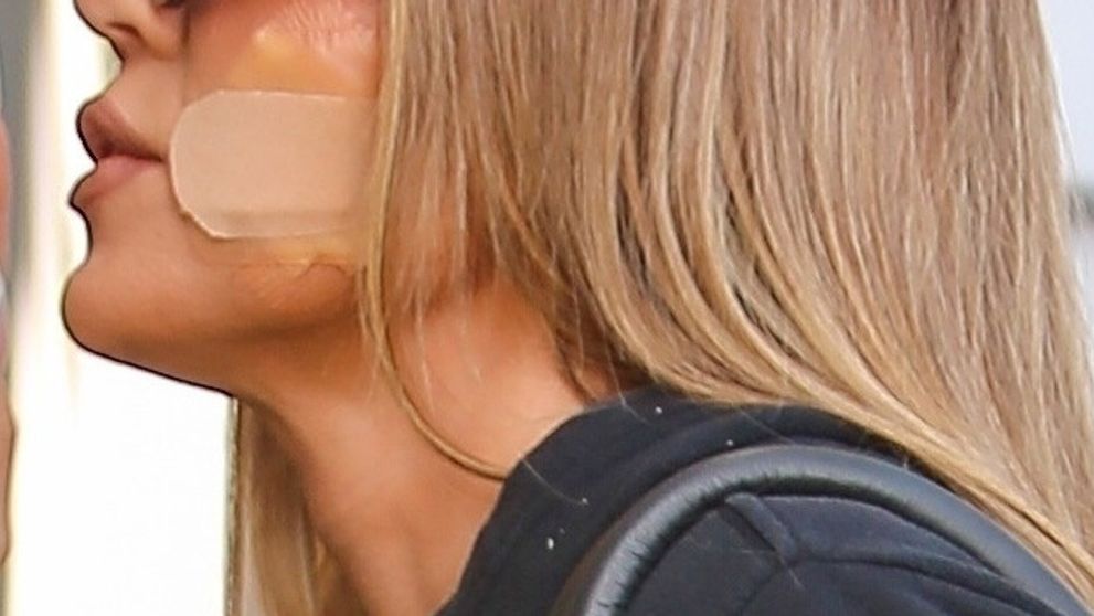 Kardashianke našli nádor: Okamžitá operácia!