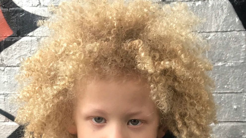 Päťročný chlapček je iný ako ostatní: Zo dňa na deň sa stal hviezdou